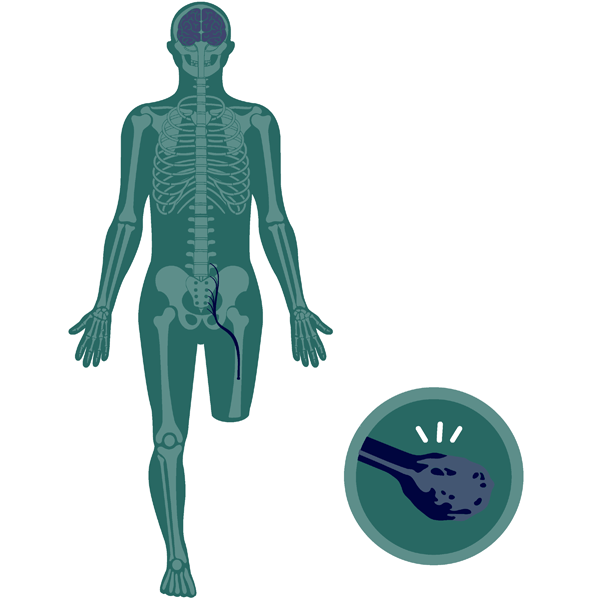 Neuros Medical Animation