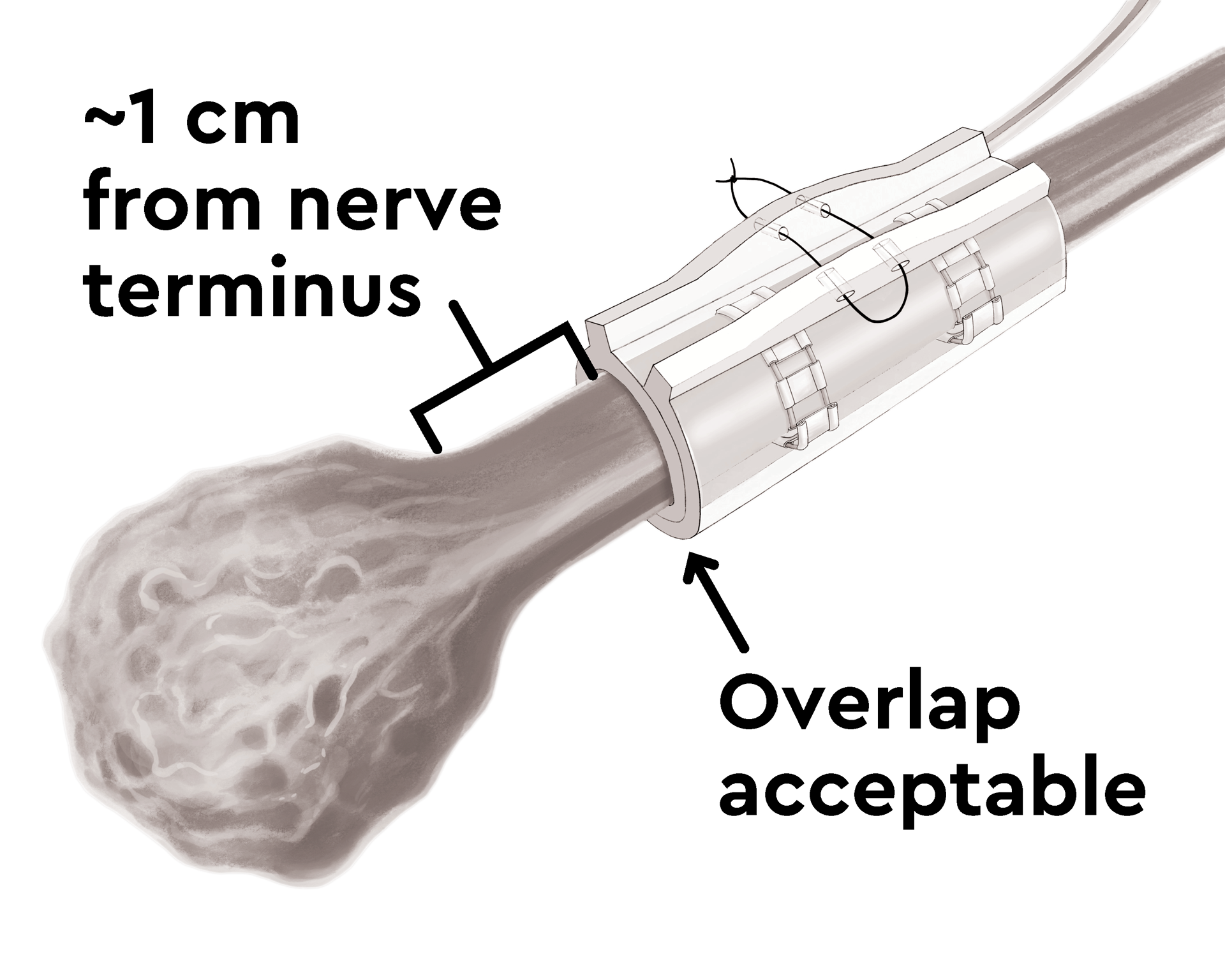 Neuros Medical Animation