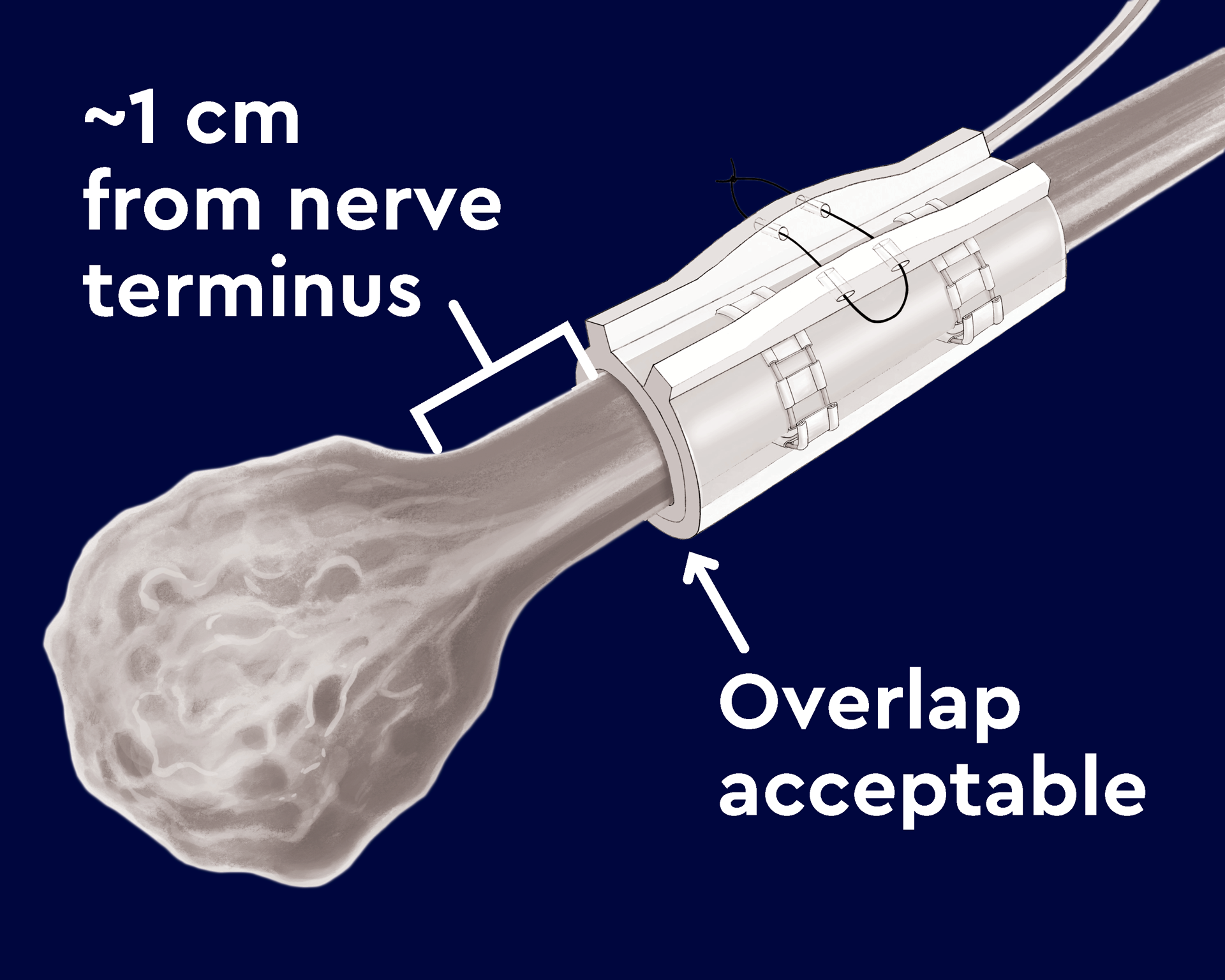 Neuros Medical Animation